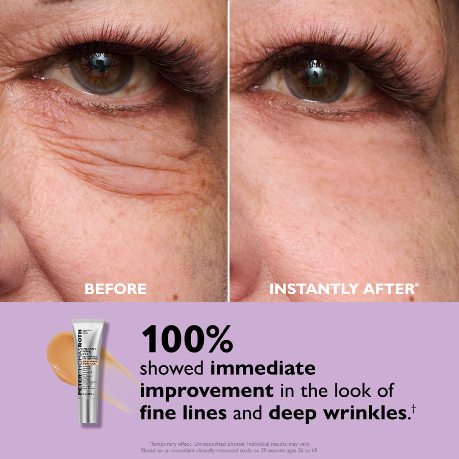 EternalEyes Tightening Cream™