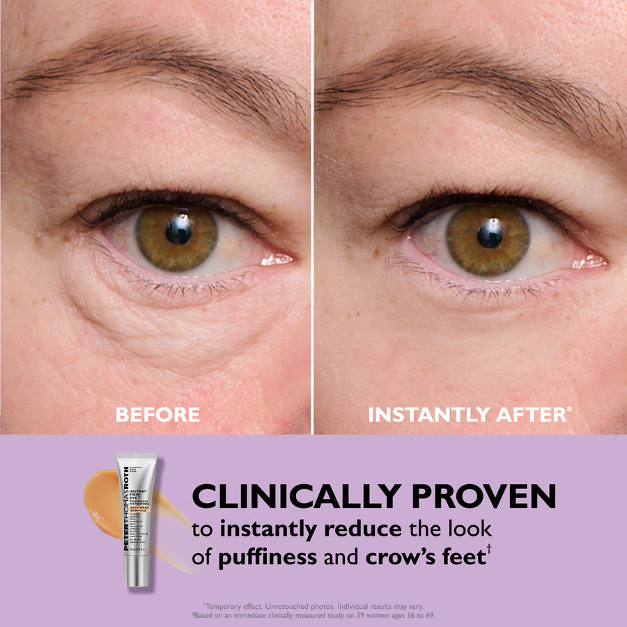 EternalEyes Tightening Cream™